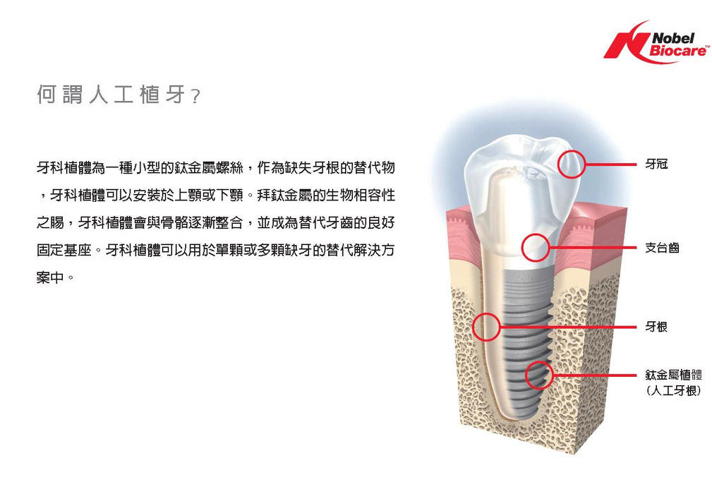 高齡牙科 | 專為銀髮族群量身訂做的口腔照護計劃