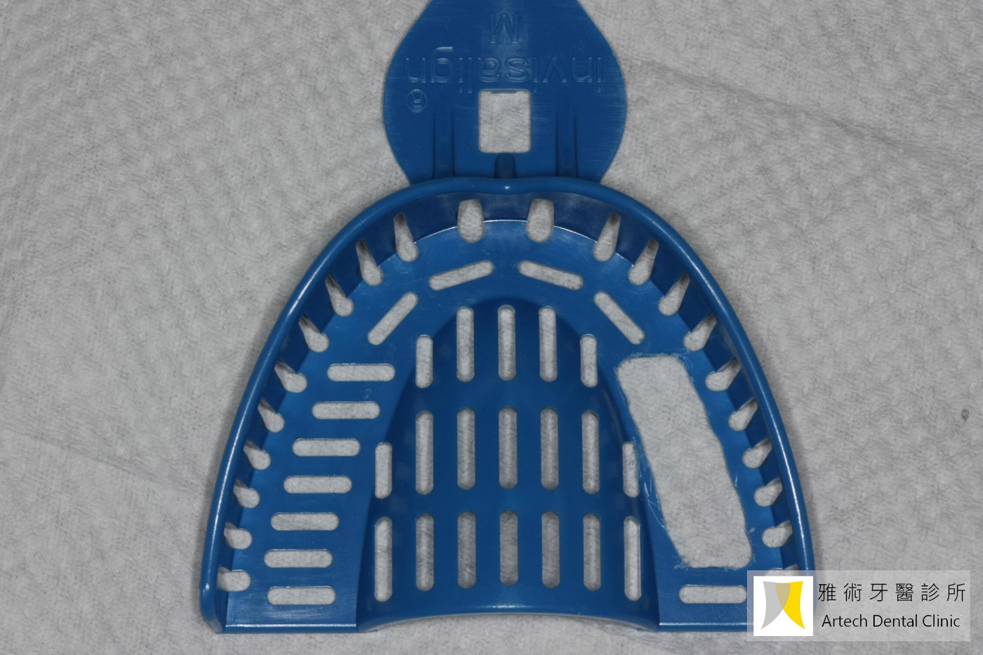 Individual tray 個人印模牙托