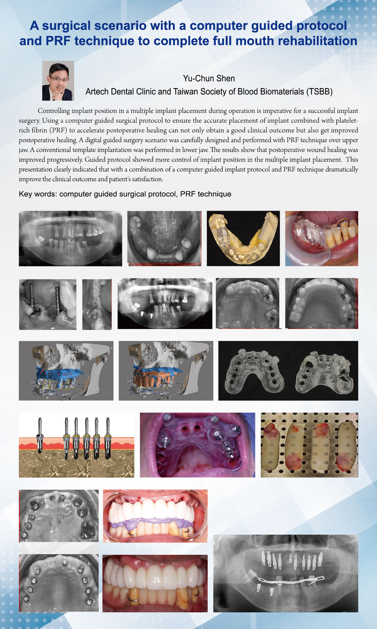 沈育群醫師實證研究《A surgical scenario with a computer guided protoco
