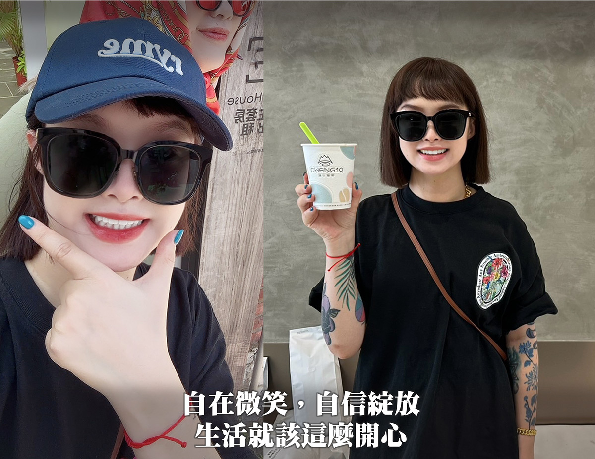4D晶鑽前牙貼片｜前牙美學｜自信生活自在微笑